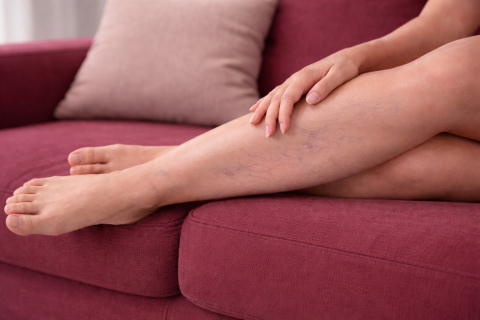 Как отличить усталость ног от венозных проблем