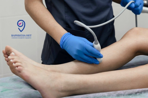 Почему варикоз может развиваться незаметно